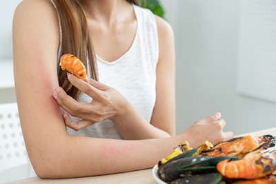 Female patient experiencing skin rash from food allergy